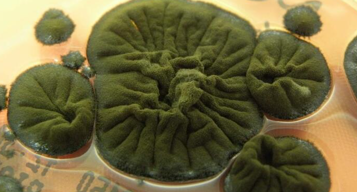 Ð§ÐµÑÐ½ÑÐ¹ Ð³ÑÐ¸Ð±Ð¾Ðº Cladosporium sphaerospermum. Ð¤Ð¾ÑÐ¾ - atlasmicologia.blogspot.com